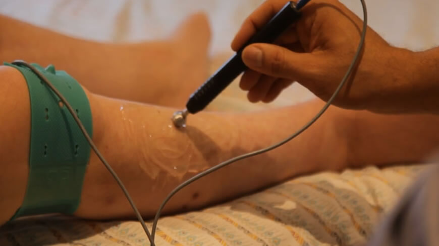 Eletroestimulação como suporte às novas tecnologias para lesões medulares